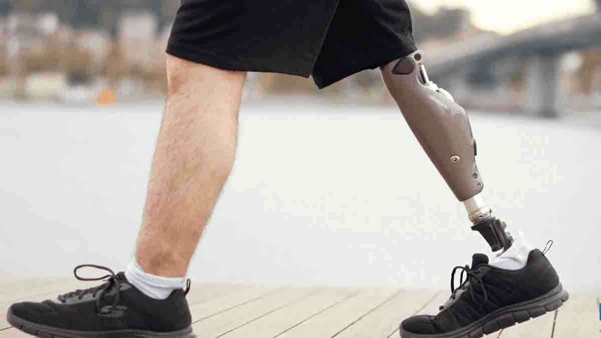 leg